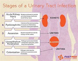 Image result for Urinary Sepsis