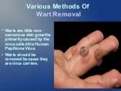 Image result for Liquid Nitrogen Genital Wart Removal