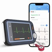 Image result for ECG Heart Rate Monitor