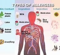Image result for What Is Allergy
