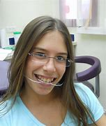 Image result for Girly Braces