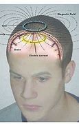 Image result for Brain with Electricity