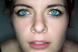 Image result for Diffrent Colored Eyes Black and White