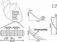 Image result for Cardiac Output Thermoset