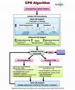 Image result for Recover CPR Als ECG Algorithm