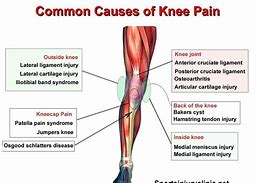 Image result for Sharp Knee Pain