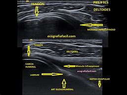 Image result for articulaci�n
