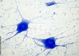 Image result for Brain Neurons Microscope