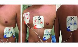 Image result for Quick Guideline of X Series Philips Defibrillator