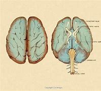 Image result for Whole Brain Diagram