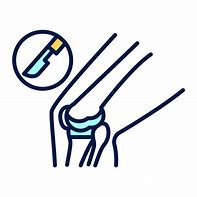 Image result for Orthopedic Knee Surgery Clip Art