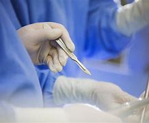 Image result for Surgical Scalpel Blood