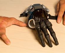 Image result for First Prosthetic Arm