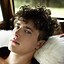 Image result for Thinning Hair in Teenage Boy