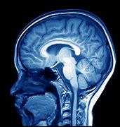 Image result for Blue and Read Brain