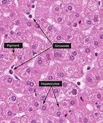 Image result for Liver Cell Histology