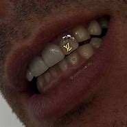 Image result for Kim K Tooth Jewlwery