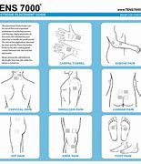 Image result for Tens Unit for Back Pain Electrode Placement