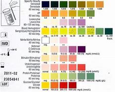 Image result for Urine Analysis Test Strips