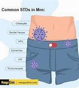 Image result for Signs of Drop in Men