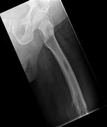 Image result for Sloth X-ray