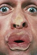 Image result for Squashed Looking Face