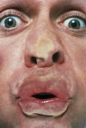 Image result for Squashed Face