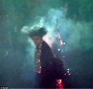 Image result for Michael Jackson Pepsi Burn