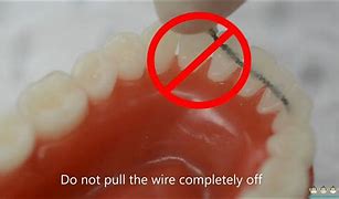 Image result for Broken Wires On Celling