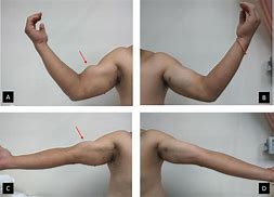 Image result for Black and White Biceps Left and Right