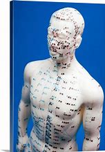 Image result for Chinese Acupuncture Art