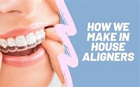 Image result for 3D Printing Aligners
