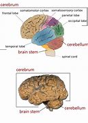 Image result for Brain Sections