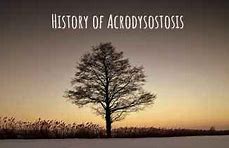Image result for acieosis
