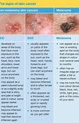 Image result for Show Photo of Skin Cancer Onset