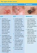 Image result for Types of Skin Cancer
