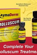 Image result for Molluscum Warts Treatment