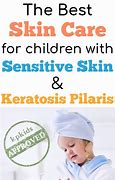 Image result for Keratosis Pilaris Treatment for Kids
