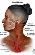 Image result for Where Is Your Carotid