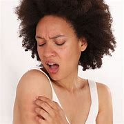 Image result for Skin Allergy Rash Treatment