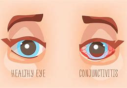 Image result for Pink Eyes Cartoon