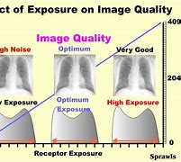 Image result for Radiographic Dynamic Range