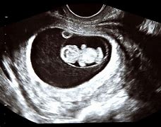 Image result for Week 9 Baby Printable