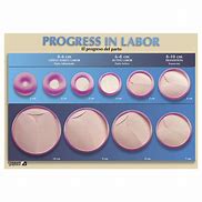 Image result for Stages of Labor Dilation
