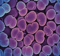 Image result for Neisseria Gonorrhoeae Under Microscope