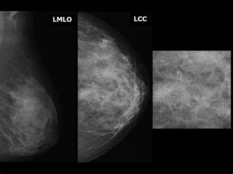 Image result for Breast Cancer Survival Prediction Using Machine Learning