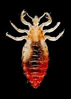 Image result for Body Lice WW1