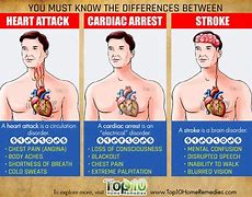 Image result for Stroke vs Heart Attack