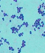 Image result for Chlamydia Trachomatis Gram Stain