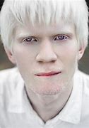 Image result for Albino Bat Color